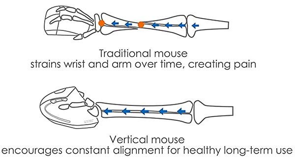 pourquoi souris ergonomique